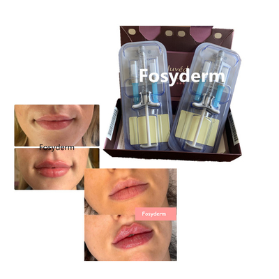Juvederm volbella Wypełniacz do ust z kwasem hialuronowym Cross Linked 24 mg