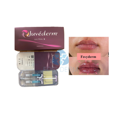 Wypełniacz skórny z kwasem hialuronowym Voluma Fosyderm do wzmocnienia ust