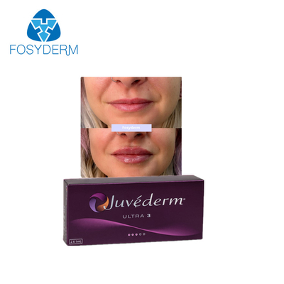 Juvederm Ultra3 Dermal Lip Fillers Cross Linked Lip Enhancement Kwas hialuronowy