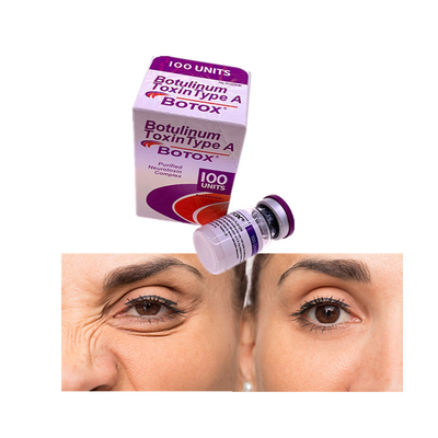 Usuwanie zmarszczek na twarzy Toksyna botulinowa 100 jednostek Allergan Botoxo
