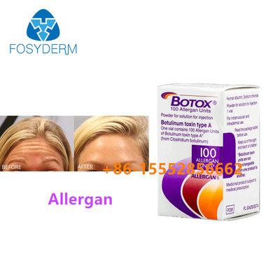 100 jednostek toksyny botulinowej, alergan, usuwają zmarszczki na twarzy, wstrzyknięcie botoksu typu A.