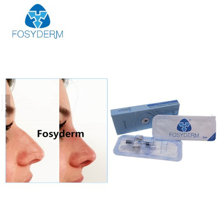 Fosyderm 1 ml Głębokie iniekcje kwasu solnego w twarz do nosa w górę