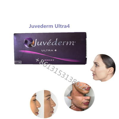 Lip Fullness Juvederm Ultra4 Allergan Dermal Filler Juvederm HA Wypełniacze do ust