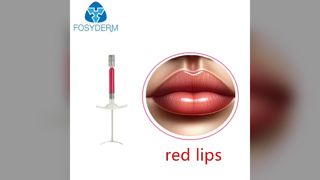 czerwone usta