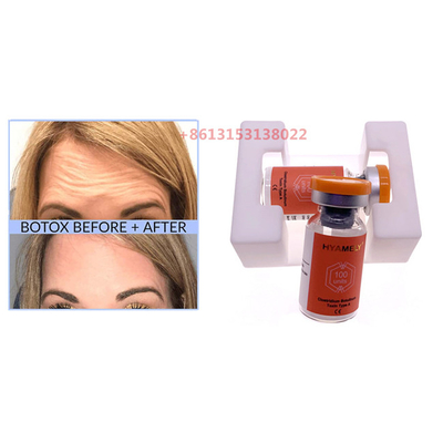 Hyamely  Toksyna botulinowa Botulax Powder Injection przeciw zmarszczkom