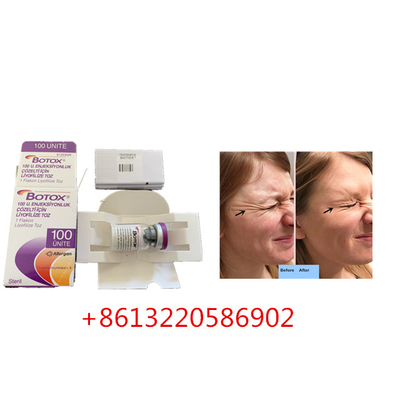 Anti Aging Allergan  Injection 100 jednostek typu A przeciw zmarszczkom