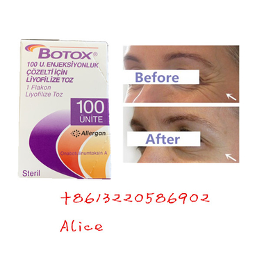 Przeciwzmarszczkowy przeciwzmarszczkowy toksyna botulinowa Allergan typu A Botox Powder