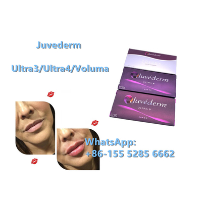 Juvederm Ultra4 24 mg / ml Wypełniacz skórny przeciwzmarszczkowy Wstrzyknięcie kwasu hialuronowego