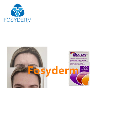 Zastrzyki z toksyny botulinowej Allergan usuwają zmarszczki 100 jednostek botoksu