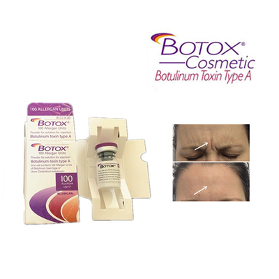 Produkty przeciwstarzeniowe Botox Injection Toksyna botulinowa typu A Dermal Filler