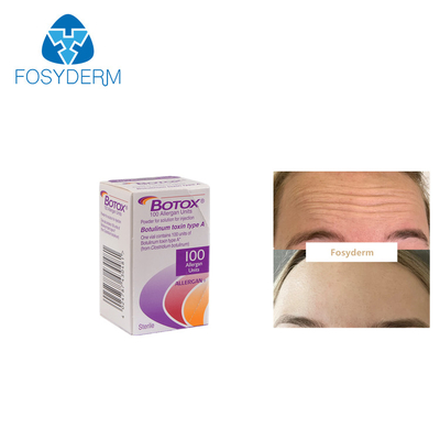 Allergan  100 jednostek toksyna botulinowa przeciwzmarszczkowy typ A zastrzyk