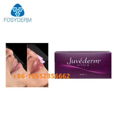 2x1ml Powiększenie ust Juvederm Dermal Filler Usieciowany kwas hialuronowy do wstrzykiwań