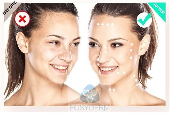 Filorga  135HA Mezoterapia Serum Zmłodzenie skóry