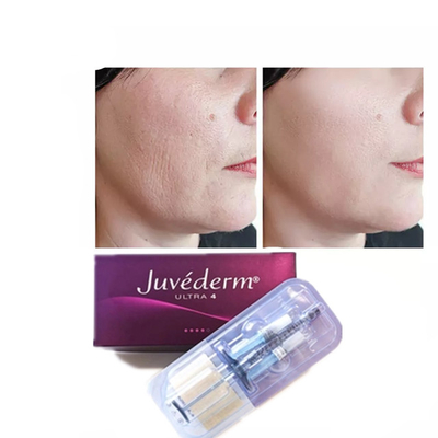 Juvederm Wypełniacz do twarzy z kwasem hialuronowym Anti Aging 2*1ml Wypełniacz do twarzy