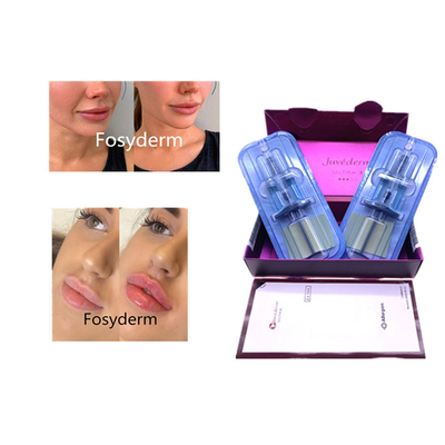 Juvederm Wypełniacz do twarzy z kwasem hialuronowym Anti Aging 2*1ml Wypełniacz do twarzy