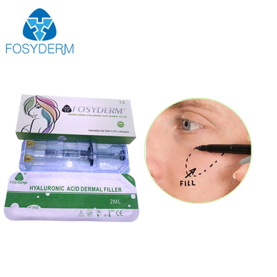 Fosyderm Deep 2ml Filler Dermal For Facial Rejuvenation HA Filler (Fosyderm głęboki 2ml filler skórny do odmłodzenia twarzy)
