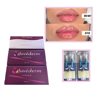 Juvederm Voluma Ultra3 Ultra4 HA Gel wypełniacze 2 ml kwasu hialuronowego