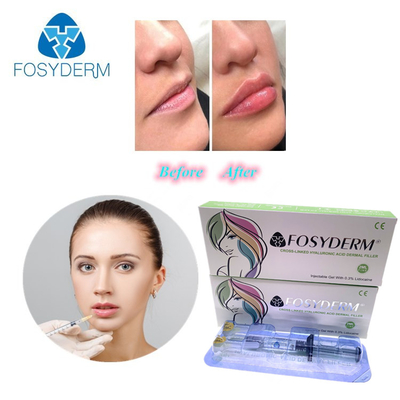 Żel 1 ml Filler z kwasem hialuronowym do zmniejszania zmarszczek i formowania twarzy