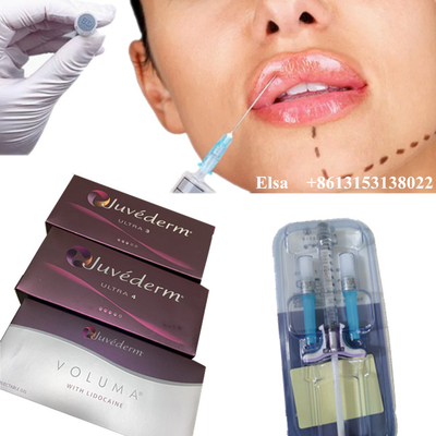 Wstrzyknięcie kwasu hialuronowego do twarzy Juvederm Ultra4 Voluma Dermal Filler Anti Wrinkles