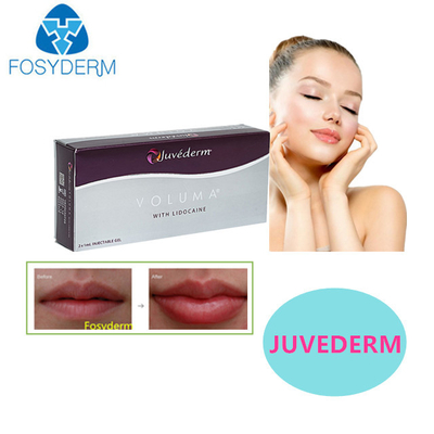 Juvederm kwas hialuronowy wypełniacz skóry
