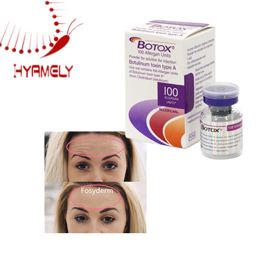 Anty -zmarszczki estetyka liofilizowana meditoksyna allergan w proszku toksyna botulinowa toksyna