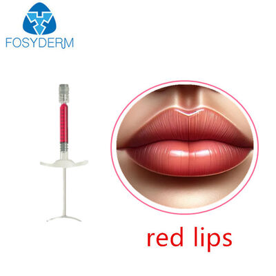 Objętość ust z witaminą B12 1 ml 24 mg/ml Wypełniacz skórny Kwas hialuronowy Czerwony wypełniacz do ust
