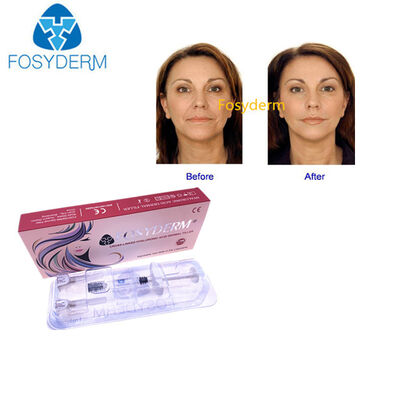 Cross Linked Gel Hyaluronic Acid Dermal Filler Cheek Plumping Injections 2.0ml
