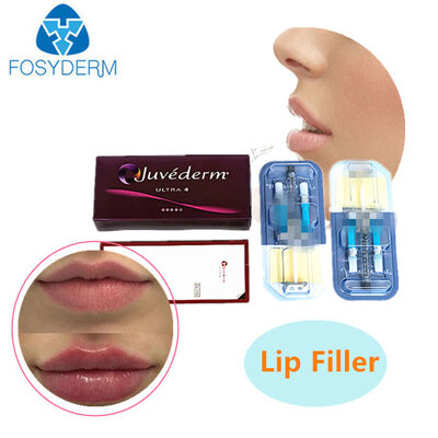 Juvederm kwas hialuronowy wypełniacz skóry do podnoszenia ust i twarzy 24 mg