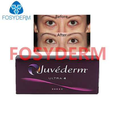 Juvederm kwas hialuronowy wypełniacz skóry do podnoszenia ust i twarzy 24 mg