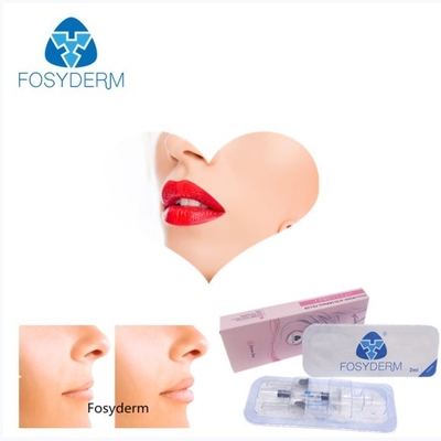 Żel Fosyderm 2 ml Cross-Hyaluronic Acid Dermal Filler do wzmocnienia ust