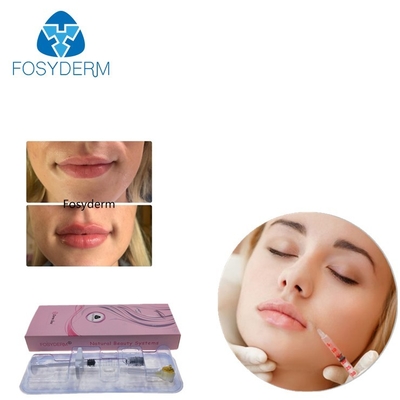 Żel Fosyderm 2 ml Cross-Hyaluronic Acid Dermal Filler do wzmocnienia ust