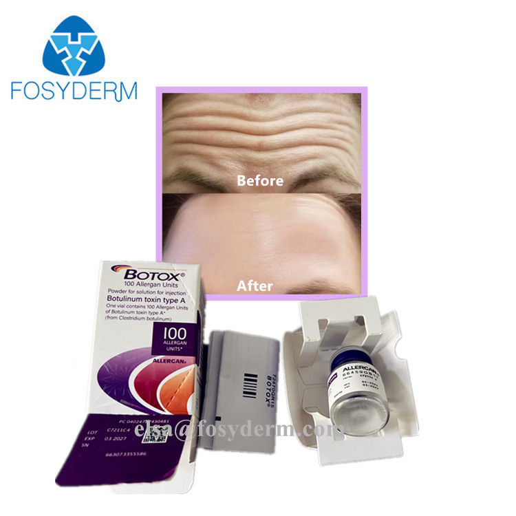 Pure Hot Dermal Fillers Anti Facial Wrinkles Botulinum Toxin 100 Units
