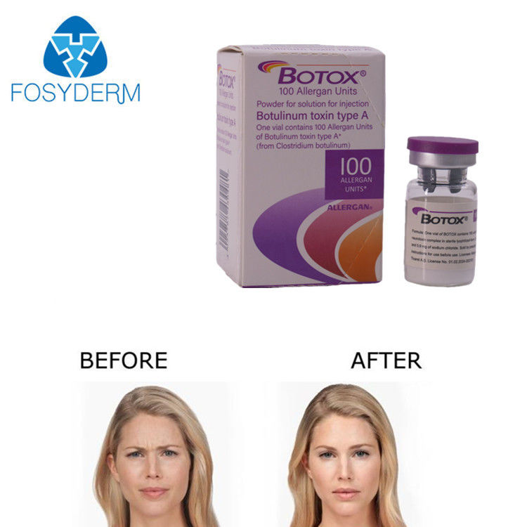 Iniekcja u Allergan 100 jednostek do usuwania zmarszczek