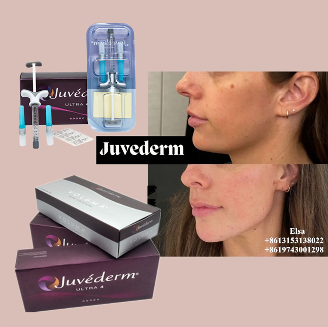 Juvederm ultra3 Juvederm ultra4 Juvederm objętość wypełniacz skórny