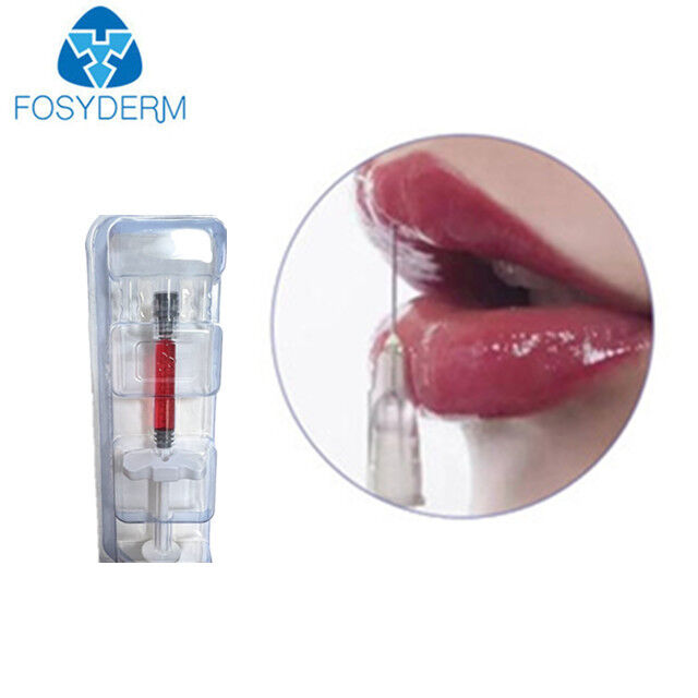 Objętość ust z witaminą B12 1 ml 24 mg/ml Wypełniacz skórny Kwas hialuronowy Czerwony wypełniacz do ust