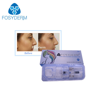 Cross Linked Injectable HA Deep Dermal Filler do szczęki nosowo-podbródkowej Zatwierdzony przez CE