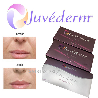 Wypełniacz twarzy z kwasem hialuronowym Juvederm Long Lasting Ultra3 Ultra4 Voluma Injection