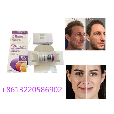 Anti Aging Allergan  Injection 100 jednostek typu A przeciw zmarszczkom