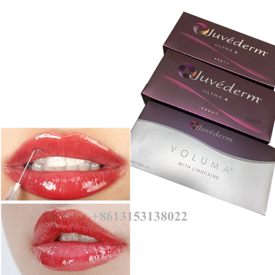 Juvederm Voluma Hyaluronic Acid Dermal Filler Gel 24mg/ml Wypełniacze skórne