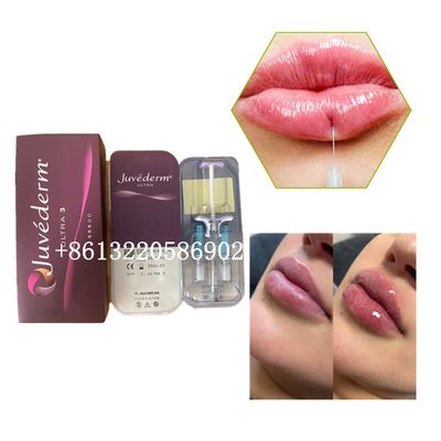 Ultra3 Juvederm Lip Filler Injection 2ml Kwas Hialuronowy Skórny