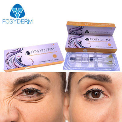 5 ml kwasu hialuronowego Fosyderm Dermal Filler Injection na usta nos