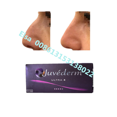Juvederm Sodium Ultra4 Voluma Dermal Filler do powiększania warg brody