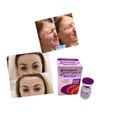 Dermal Filler Przeciwzmarszczkowy Allergan  100 jednostek Botulinum Powder Injection
