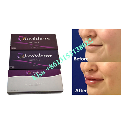 Voluma Kwas hialuronowy Fosyderm Wypełniacz skórny Zastrzyk 24mg/Ml
