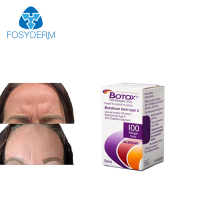 Przeciwzmarszczkowy  De Allergan 100 jednostek zastrzyku