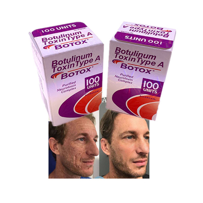 Proszek do wstrzykiwania botoksu Allergan Cosmetics Anti Aging Wrinkle 100 jednostek