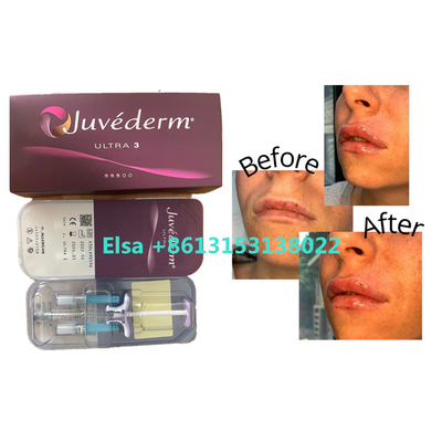 Produkty Kosmetyczne Juvederm Dermal Filler Do Ust Twarzy