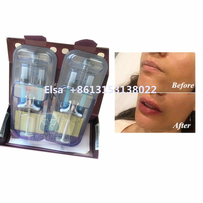 Produkt kosmetyczny Juvederm Voluma kwas hialuronowy wypełniacz twarzy HA wstrzyknięcie