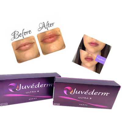 Kwas hialuronowy Dermal Gel Injection Juvederm Lip Filler Ce Anti Aging 2ml