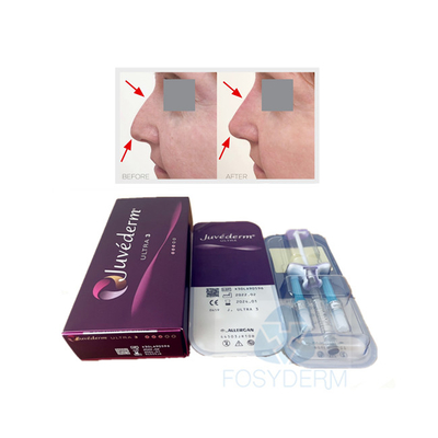 Usieciowany wypełniacz do ust do twarzy Juvederm Ultra3 Żel z kwasem hialuronowym